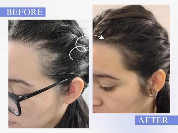 Before and after - Kim