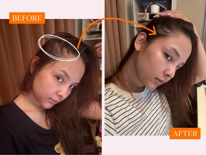 Before and after - Karen Patdu