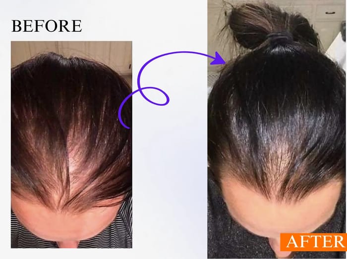 Before and after - Andrea Burns