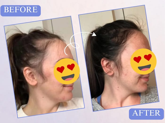 Before and after - Anna Koval