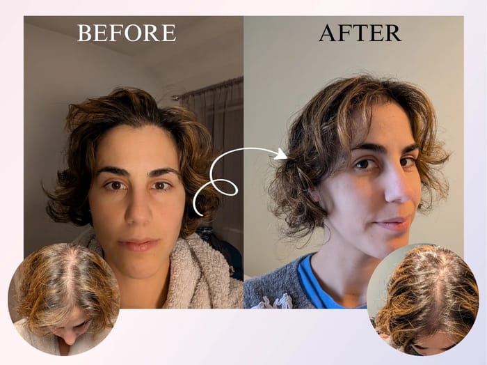 Before and after - Yer Yang